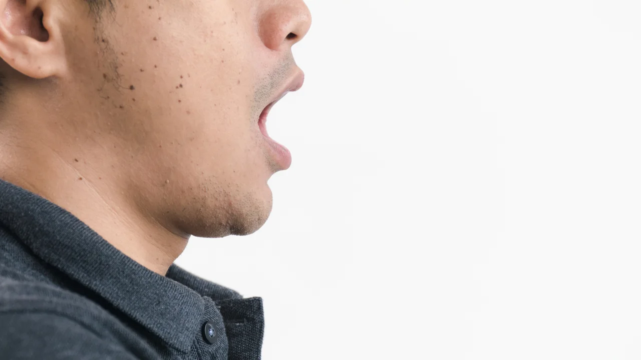 The Hidden Link Between Nasal Obstruction and Uncontrollable Diabetes