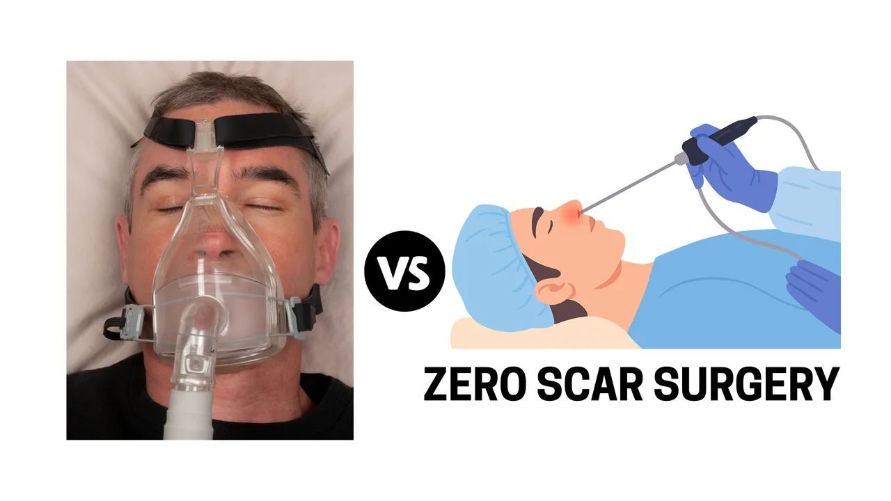 Illustration: Snoring or OSA – CPAP vs Surgery: What’s Best for Long-Term Relief?